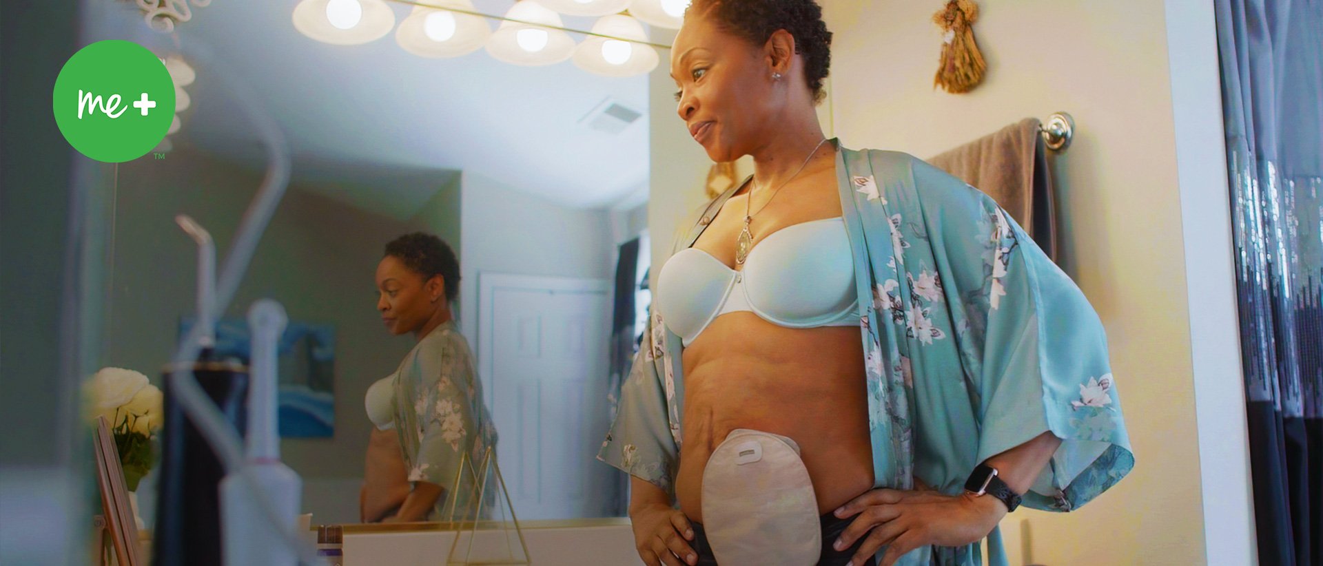 ostomi torbası olan bir kadın