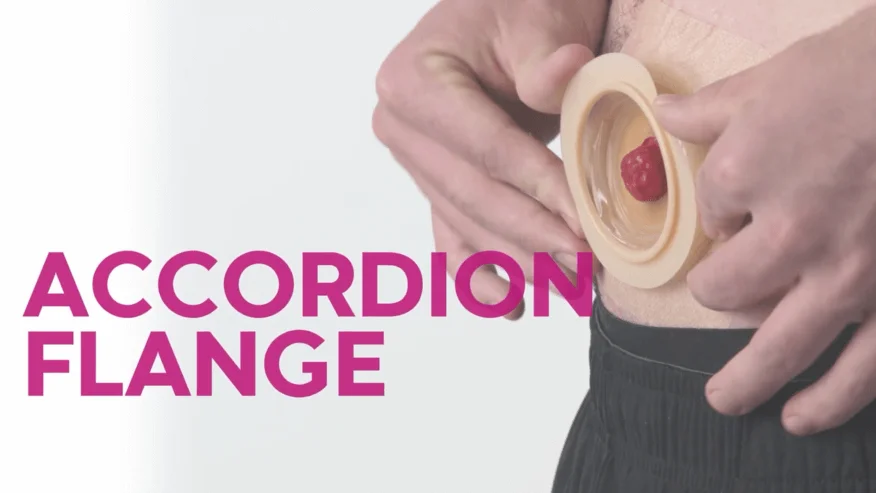 A video thumbnail of 'Ostomy Pouching Systems with Accordion Flange Skin Barriers'