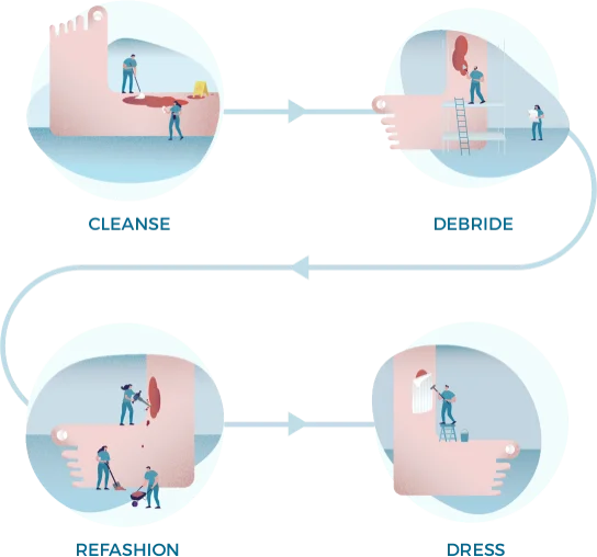 En illustrasjon av Wound Hygiene's 4 trinn: Rense, Debridere, Optimalisere, Bandasjere