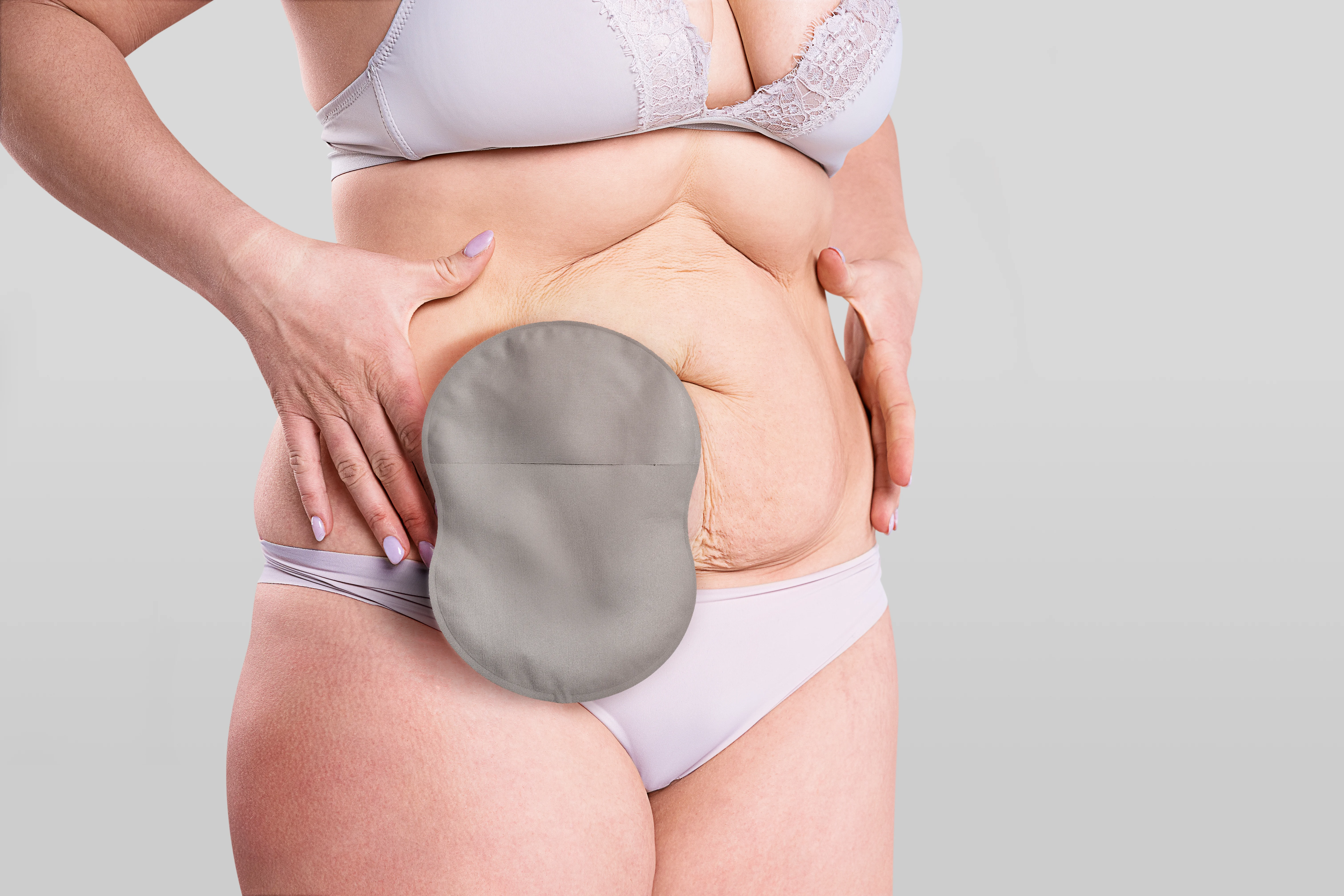 Woman wearing Esteem Body ostomy system