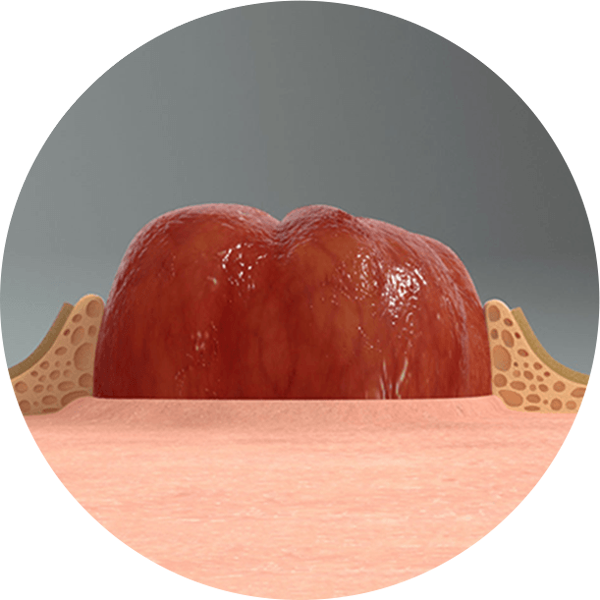 LEAK-LOCK™系統的特寫