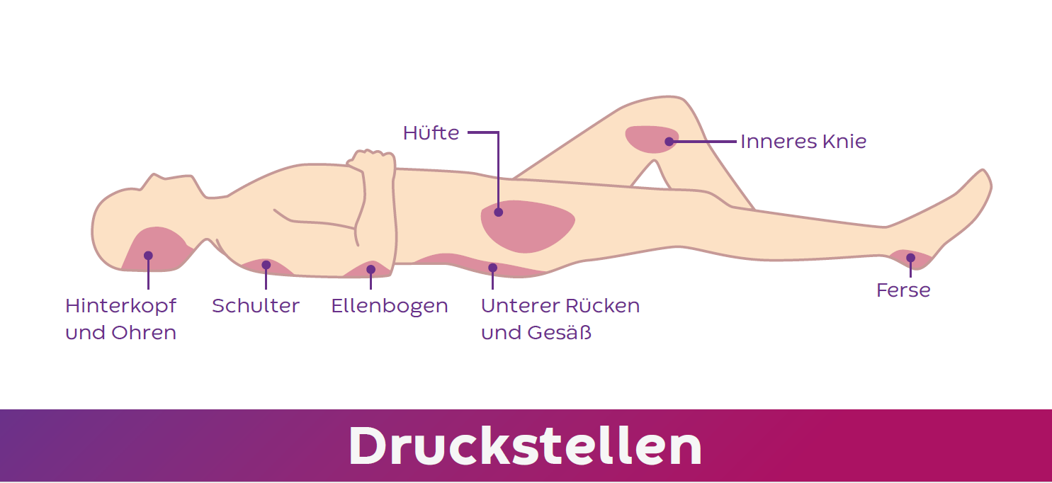 Gefährdete Körperstellen für Druckstellen